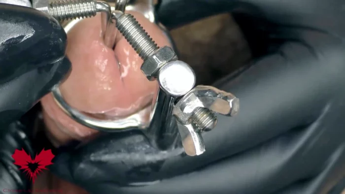 Close Up Of The Application Of A 3-Way Urethral Stretcher. The Dilator Is Used To Pre-Stretch - CLOSE UP EXTREME - MP4