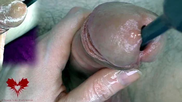 Super Close-Up Of The Glans. Urethral Games With The Dilator - CLOSE UP EXTREME - MP4