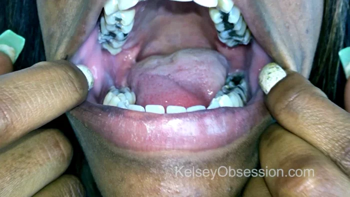 Mouth Fetish - Amber Cream's Cavities And Uvula - KELSEYOBSESSION - MP4