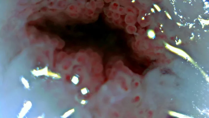 Cervix Closeup Heartbeat - ADULTING X - SOFIE - MP4