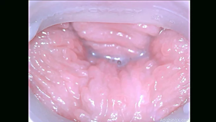 Cervix Magnified Heartpounding Orgasms - ADULTING X - SOFIE - MP4