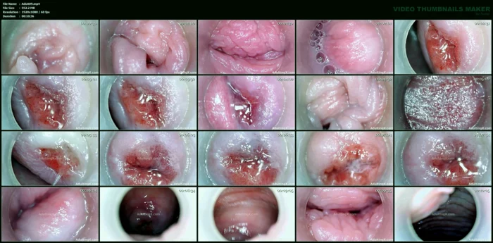 Cervix Magnified Pussy Parts - ADULTING X - SOFIE - MP4