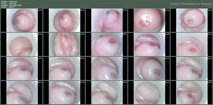 Raw Beautiful Cervix Inside Pussy - ADULTING X - SOFIE - MP4