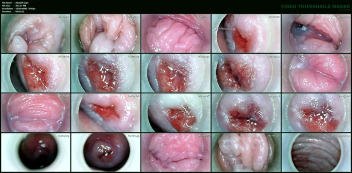 Raw Magnified Pussy And Cervix - ADULTING X - SOFIE - MP4