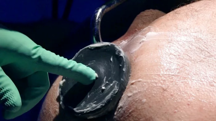 Absolute Anal Treatment - MARCUS POLLACK - MP4