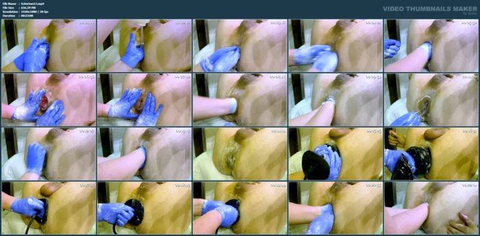 Double Fisting For A Patients Asscunt - SCHWESTER SANDRA / SANDRA BIZARR - MP4