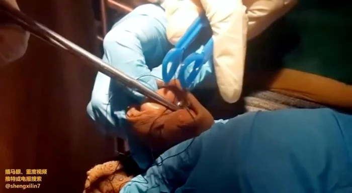 Snow Queen's Double Main Cooperation Medical Adjustment - EROSMAYAN7 - MP4