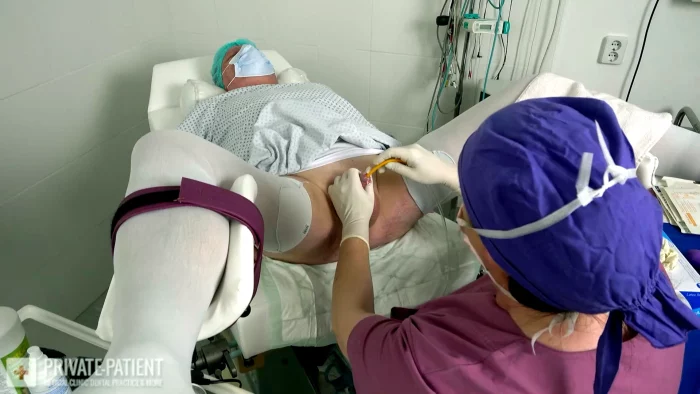 More Gloves 04 - PRIVATE-PATIENT - MP4