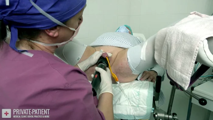 More Gloves 06 - PRIVATE-PATIENT - MP4