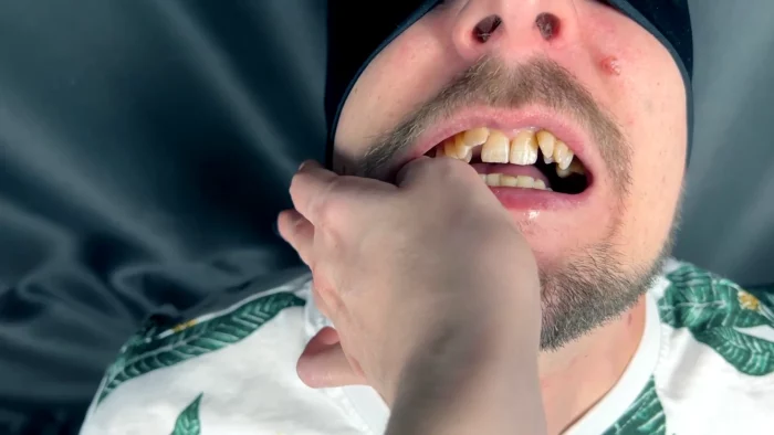 Guy Biting Fingers His Molars - Male Vampire Teeth - MOMMY HOUSE / DOMINA LEE / STEPMOMMY HOUSE - MP4